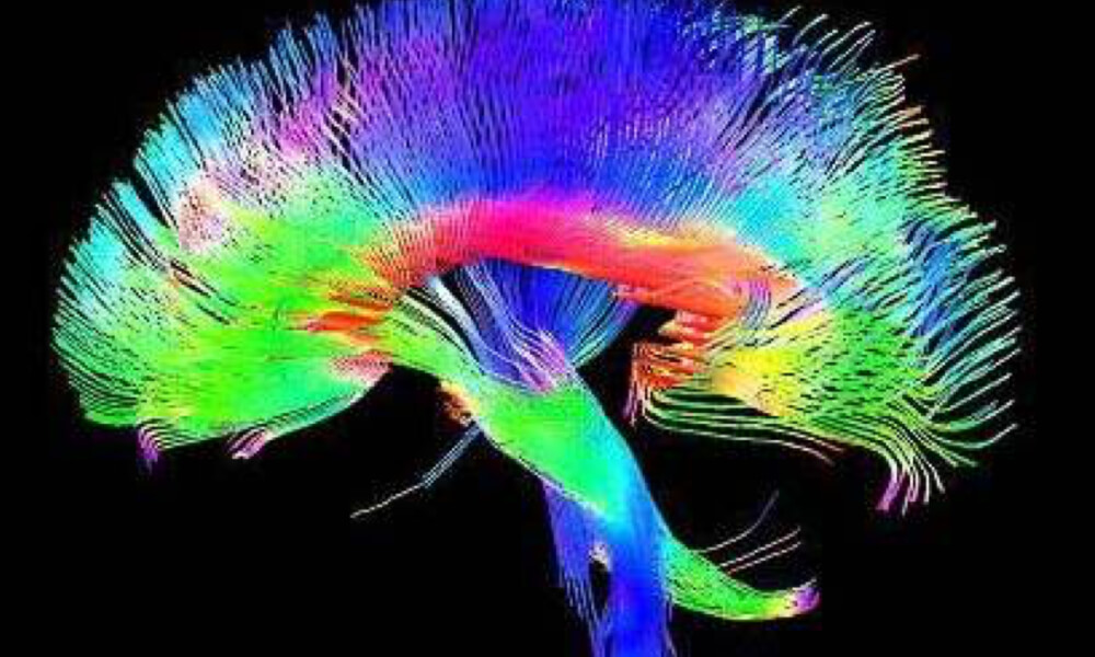 Image for Research Associate x 4 (Fixed Term) in Department of Psychiatry