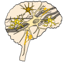 Image for Early-stage stem cell therapy trial shows promise for treating progressive MS